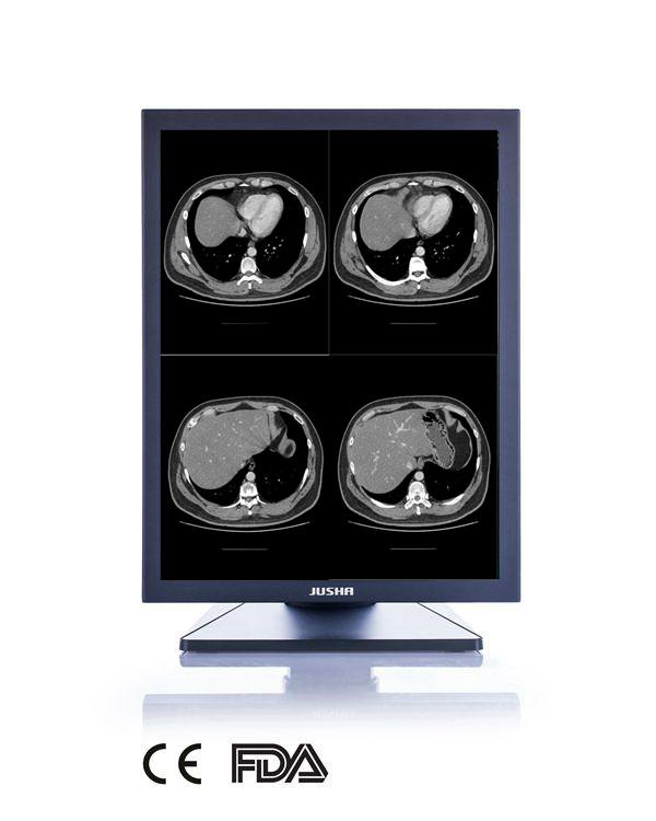 3MP 21-Inch 2048X1536 LCD Screen Monochrome Monitor, CE, FDA Approved, Veterinary X Ray Equipment