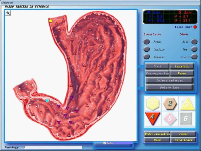 with Repair and Therapy 3D Nls Health Analyzer with Original Software 3D Health Analyzer