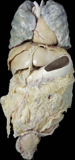 Whole Viscera