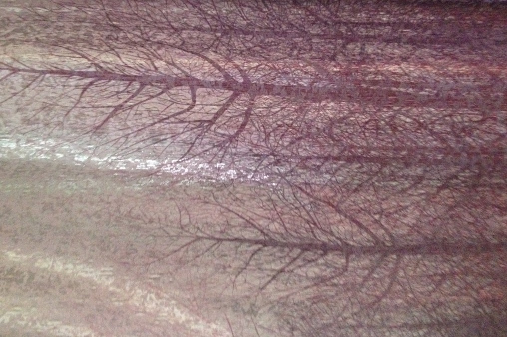 Fabric