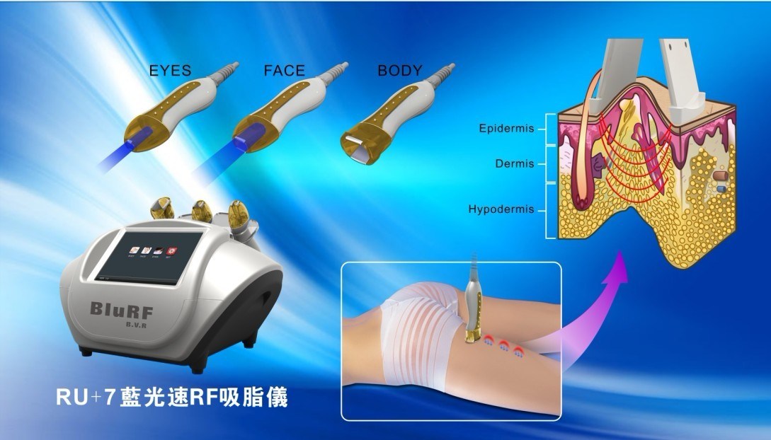 Portable Liposuction Vacuum & RF & Blue Light Beauty Equipment
