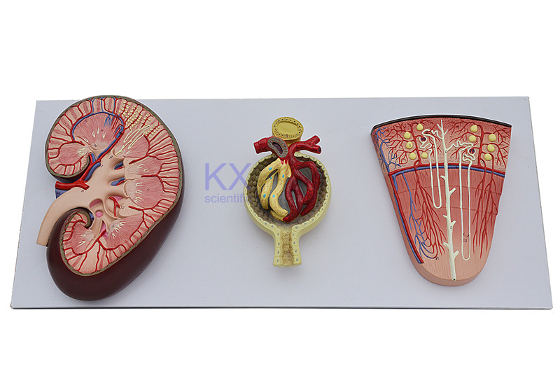 Enlarged Kidney Nephron and Glomerulus Model