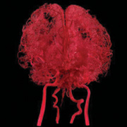 Ventricles of The Brain (Casting Specimen)