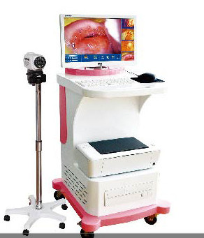 New Colposcope Equipment for Vaginal Examination