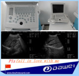 Newest Laptop Ultrasound Diagnostic Equipment for Obsterics