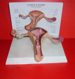 Se34093 Pathological Uterus Model