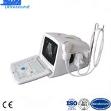 Medical Equipment Portable Ultrasound Scanner
