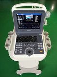 Popular Color Doppler Ultrasound Scanner Trolley