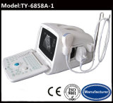 Portable Ultrasound Scanner Medical Equipment with CE