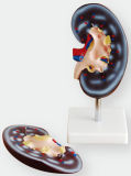 Zoom 2 Times Kidney Model Weichengya