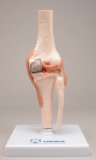 Anatomical Model - AB114 Knee Osteoporosis Model