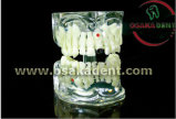 Dental Teaching Model of Whole Teeth Shape