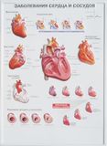 Raised Anatomical Chart
