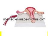 The Model of Normal Utetus (EYAM-23) 