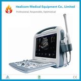 Hy2000 Hot Sale Full Digital Portable Color Doppler Ultrasound Scanner