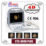 4D Ultrasound Imaging System Obstetrics, Gynecology, Tissue Harmonic Imaging, Compound Imaging, 4D Transducer, Volumetric Probe