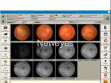 Fundus (retina) Camera Software for Imaging Processing