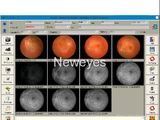 Fundus (retina) Camera Software for Imaging Processing