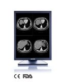 3MP 21-Inch 2048X1536 LCD Screen Monochrome Monitor, CE, FDA Approved, Digital Dental X Ray Equipment