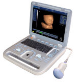 4D Ultrasound Machine Ent Medical Equipment Price