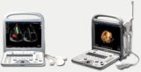Trolley Ultrasound & Medical Ultrasound Diagnostic Equipment