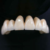 Dental Porcelain Fused to Metal Crown Lab (CaRong-362)