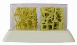  AB112 Bone Density Model