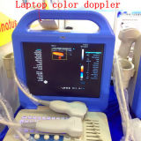 Ultrasound Machine Color Doppler/Medical Laptop Color Doppler/Portable Ultrasound Scanner/Medical Equipment/Color Doppler Ultrasound Price/Equipments