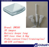 Laptop Gynecological Ultrasound Equipment