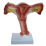 New Female Internal Genital Oragan Model