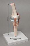 Anatomical Model - AB115 Artificial Joint Knee Model