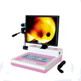 Jy-2520 Infrared Galactophore Diagnosis Instrument