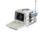 Medical Equipment-Portable Ultrasound Scanner Machine