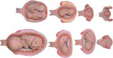 Fetus Development Model Set Mh09002
