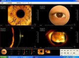Patients Database / Pacs for Slit Lamp/ Ab Scan/ Slit Lamp/ Surgical Microscopes