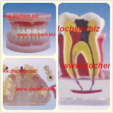 Demotex Dental Study Model
