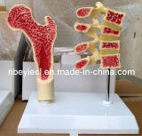 3D Anatomical Model of Thighbone (EYAM-07)