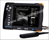 7 Inch Bovine Ultrasound Scanner--CD66V