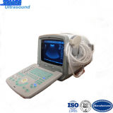 B/W Portable Ultrasound Diagnostic System of Medical Equipment