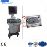 Trolley Ultrasound Equipment with LED Monitor /Ultrasound Machine