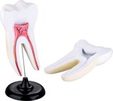 Enlarged Model of Teeth-Mh06004