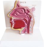 Dessection Model of Nasal Cavity-Mh06014