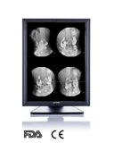 3MP 21-Inch 2048X1536 LED Screen Monochrome Monitor, CE, FDA Approved, Veterinary X Ray Equipment