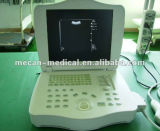 15 Inch Medical Digital Portable Ultrasound Equipment