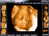 Software for 3D Ultrasound Workstation