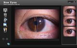 Professional Software for Slit Lamp