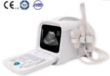 Handheld Ultrasound Device Machine Diagnostic Scan Software