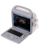 Medical Equipments Portable Ultrasound Scanner Am-580A Color Doppler