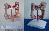 Colon Models