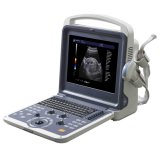 Full Digital Ultrasound Equipment (K6)